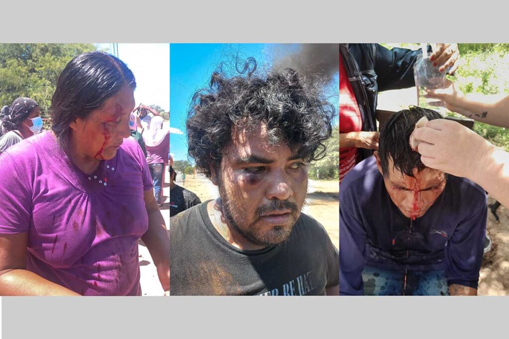 Heridos por la represion policial en el conflicto en Nueva pompeya por la desaparición de Salustiano Gimenez, Chaco Wichi
